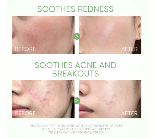 SKINTIFIC - Mugwort Anti Pores & Acne Clay Mask Stick - 40g