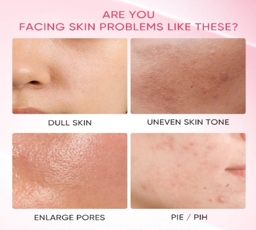 SKINTIFIC - Niacinamide Bright Boost Clay Stick - 40g