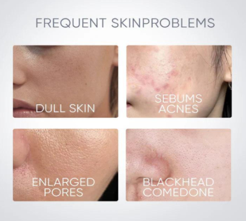 SKINTIFIC - Alaska Volcano Pore Clay Stick - 40g