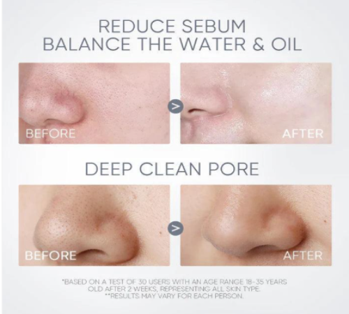 SKINTIFIC - Alaska Volcano Pore Clay Stick - 40g